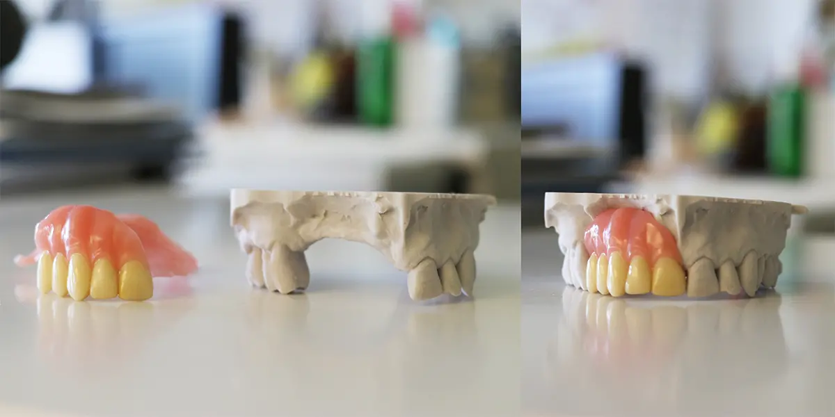 En grå, avgjuten käke där det saknas flera tänder. Bredvid ligger en rosa del av tandkött, med de tänder som saknas. På bilden till höger har detta infogats i den grå mallen och passar perfekt.